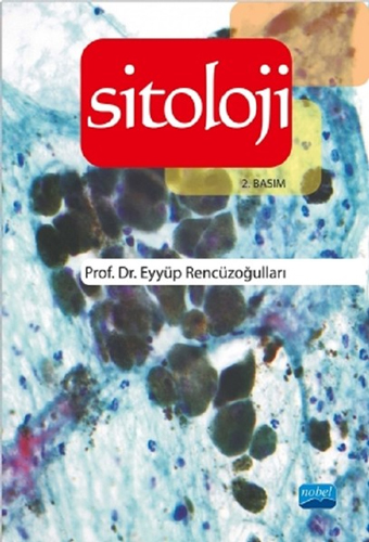 Sitoloji