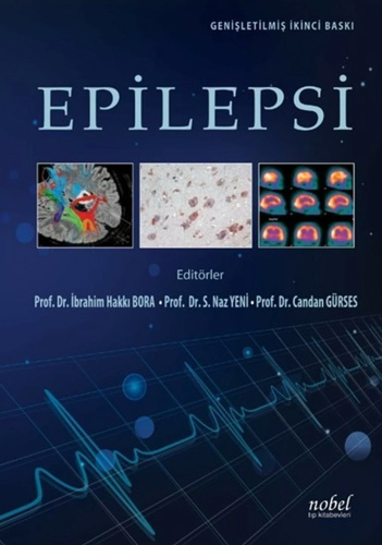 Epilepsi