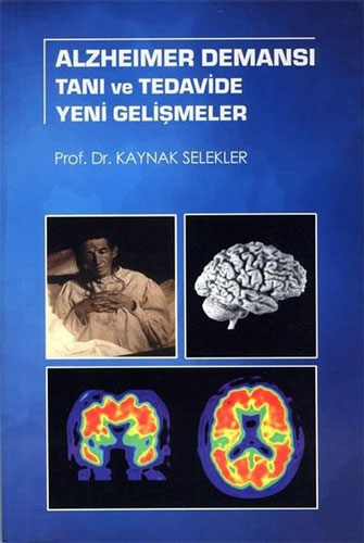 Alzheimer Demansı Tanı ve Tedavide Yeni Gelişmeler 